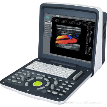 FULL DIGITAL COLOR DOPPLER DIAGNOSTICL SYSTEM